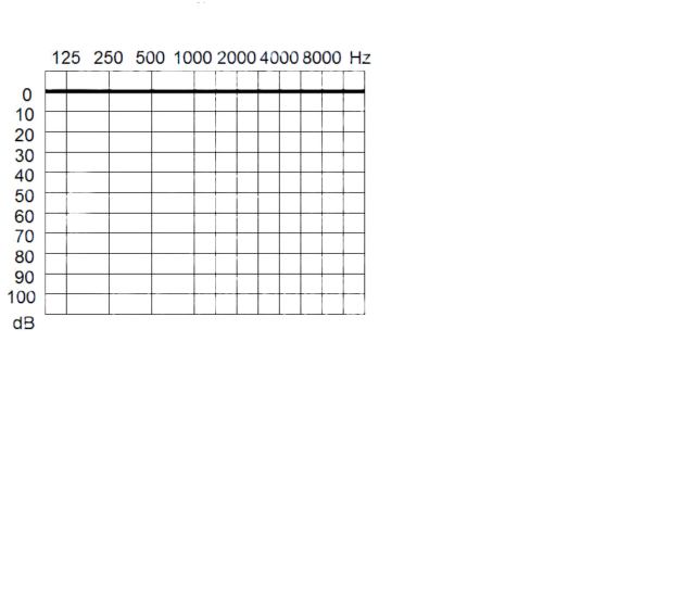 Hördiagramm leer für Anreisser
